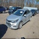 1G1BE5SM2H7122281 2017 Chevrolet Cruze Lt Auto auction photo thumbnail 2