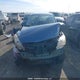 JM1BL1UF0B1435554 2011 Mazda Mazda3 Gx auction photo thumbnail 12