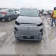 KM8K23AG1LU063147 2020 Hyundai Kona Sel auction photo thumbnail 13