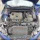 3KPFL4A75HE020736 2017 Kia Forte auction photo thumbnail 10