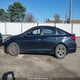 5NPE24AFXHH514012 2017 Hyundai Sonata Se auction photo thumbnail 13