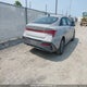 KMHLM4DG6SU912672 2025 Hyundai Elantra Sel Sport auction photo thumbnail 4