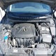 KMHDH4AH6FU418341 2015 Hyundai Elantra Gls auction photo thumbnail 10
