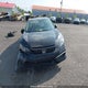 2HGFC2F59MH000291 2021 Honda Civic auction photo thumbnail 13