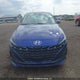 KMHLN4AG1NU351416 2022 Hyundai Elantra Ultimate Ivt auction photo thumbnail 11