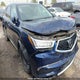 5J8YD4H4XLL802324 2020 Acura Mdx auction photo thumbnail 1