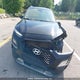 KM8K6CAA2JU173363 2018 Hyundai Kona 2.0L Luxury auction photo thumbnail 13