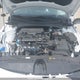 KMHLM4DG3SU021917 2025 Hyundai Elantra Sel Sport auction photo thumbnail 10