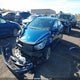 KMHDH4AE2FU452640 2015 Hyundai Elantra Sport Appearance auction photo thumbnail 2