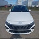 KMHLM4DG1RU753988 2024 Hyundai Elantra Sel auction photo thumbnail 13