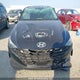 KMHLN4AG6MU090735 2021 Hyundai Elantra Ultimate Ivt With Tech Package auction photo thumbnail 12