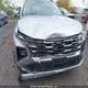KM8JCCDE9SU428269 2025 Hyundai Tucson Sel auction photo thumbnail 6