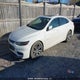 1G1ZE5ST2GF225257 2016 Chevrolet Malibu Lt auction photo thumbnail 2