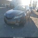 19UUA9F56BA800211 2011 Acura Tl auction photo thumbnail 2