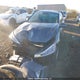 KMHD74LF8KU880683 2019 Hyundai Elantra Se auction photo thumbnail 2