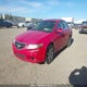 JH4CL95854C804417 2004 Acura Tsx auction photo thumbnail 2