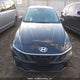 KMHLM4DG4RU666831 2024 Hyundai Elantra auction photo thumbnail 13