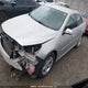 1G11B5SL4FF257356 2015 Chevrolet Malibu auction photo thumbnail 2