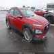 KM8K2CAA4JU157421 2018 Hyundai Kona Sel auction photo thumbnail 1