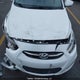KMHCU4AE3GU022169 2016 Hyundai Accent Gls auction photo thumbnail 10
