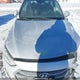 KMHD84LF3HU294320 2017 Hyundai Elantra Se auction photo thumbnail 10
