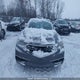 19UUB3F55JA800953 2018 Acura Tlx Tech auction photo thumbnail 11