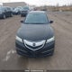 19UUB1F59FA802202 2015 Acura Tlx Tech auction photo thumbnail 12