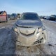 19UUA96509A801414 2009 Acura Tl auction photo thumbnail 13