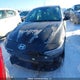 KMHLM4DG1SU969376 2025 Hyundai Elantra Sel Sport auction photo thumbnail 13