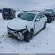 1G1ZD5ST4NF198207 2022 Chevrolet Malibu Lt auction photo thumbnail 2