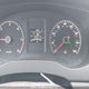 3VWLL7AJXBM124455 2011 Volkswagen Jetta Tdi auction photo thumbnail 7