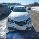19UUB3F75FA804123 2015 Acura Tlx Elite auction photo thumbnail 12