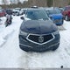 19UUB3F53KA801004 2019 Acura Tlx Technology auction photo thumbnail 12