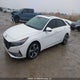 KMHLN4AG4MU069544 2021 Hyundai Elantra Ultimate Ivt With Tech Package auction photo thumbnail 2