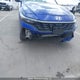 KMHLM4DG4SU036216 2025 Hyundai Elantra Sel Sport auction photo thumbnail 6