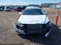 Photo 12 of 16 — 2017 Hyundai Elantra