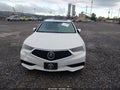 2018 Acura TLX — photo 12 of 16 | VIN 19UUB2F56JA004299