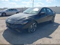 2025 Hyundai Elantra — photo 2 of 17 | VIN KMHLM4DG9SU059961