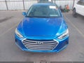Photo 6 of 11 — 2017 Hyundai Elantra