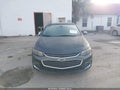 Photo 11 of 17 — 2017 Chevrolet Malibu
