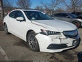 2015 Acura TLX — photo 1 of 16 | VIN 19UUB2F52FA009457