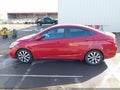 Photo 14 of 16 — 2017 Hyundai Accent