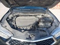 2018 Acura TLX — photo 10 of 16 | VIN 19UUB3F56JA003420