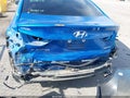 Photo 6 of 17 — 2018 Hyundai Elantra