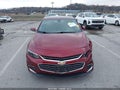 2017 Chevrolet Malibu — photo 12 of 17 | VIN 1G1ZE5ST5HF165072