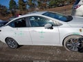 Photo 13 of 17 — 2020 Nissan Versa