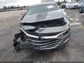 2024 Chevrolet Malibu — photo 6 of 16 | VIN 1G1ZB5ST2RF247075