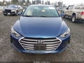 Photo 12 of 18 — 2018 Hyundai Elantra