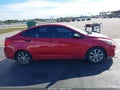 Photo 13 of 16 — 2014 Hyundai Accent