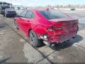 Photo 3 of 16 — 2019 Acura TLX